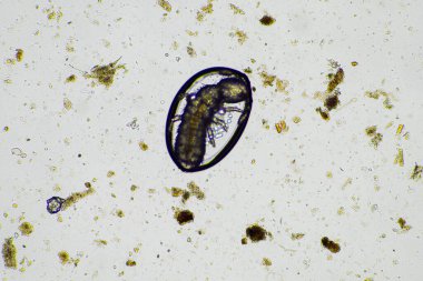 soil microorganisms in a soil life sample from a sustainable agriculture farm. living food web or bacteria fungi and protozoa in australia clipart