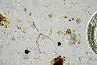 soil microorganisms in a soil life sample from a sustainable agriculture farm. living food web or bacteria fungi and protozoa in australia clipart
