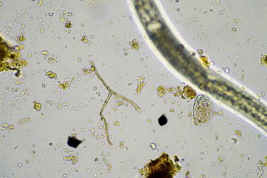 mikroorganizmalar ve toprak biyolojisi, mikroskop altında nematodlar ve mantarlar. Avustralya 'da bir toprak ve gübre örneğinde.