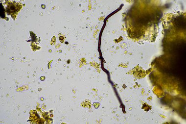 mikroorganizmalar ve toprak biyolojisi, mikroskop altında nematodlar ve mantarlar. Avustralya 'da bir toprak ve gübre örneğinde.