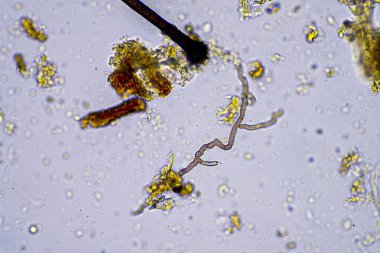fungal hyphae and soil fungi in a soil sample, showing the living soil form a farm under the microscope clipart