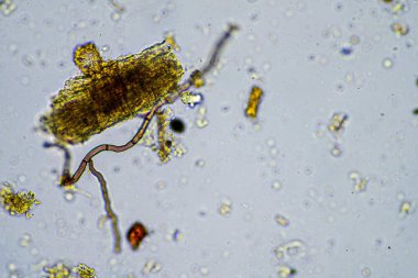 mikroorganizmalar ve toprak biyolojisi, mikroskop altında nematodlar ve mantarlar. Avustralya 'da bir toprak ve gübre örneğinde.