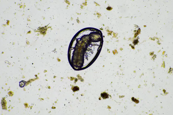 stock image soil microorganisms in a soil life sample from a sustainable agriculture farm. living food web or bacteria fungi and protozoa in australia