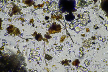 Bir laboratuarda amip, kırbaç, nematod, mantar, bakteri, virüs ve hayvan ve insan sağlığı hastalıklarını içeren mikroskop altında bulunan mikroorganizmalar