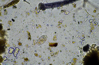 mikroorganizmalar ve toprak biyolojisi, mikroskop altında nematodlar ve mantarlar. Toprakta ve gübre örneğinde