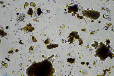 mikroorganizmalar ve toprak biyolojisi, mikroskop altında nematodlar ve mantarlar. Toprakta ve gübre örneğinde