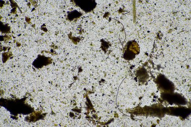 Kompost mikroorganizmaları mikroskop altında amip, kırbaç, nematodlar, mantarlar, bakteriler