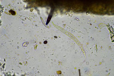 Biyoloji mikroskop altında amip, kırbaç, nematod, mantar, bakteri