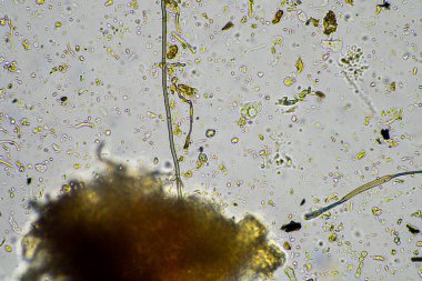 Mikroskopi altında toprak, kum, çamur ve toprak biyolojisi, amip, mantar, mikrop ve bir sığır çiftliğindeki nematodlara bakıyor.