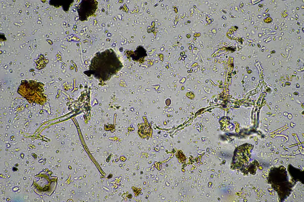 stock image soil microorganisms under a microscope including amoeba, flagellates, nematodes, fungi, bacteria from a healthy forest bush national park research