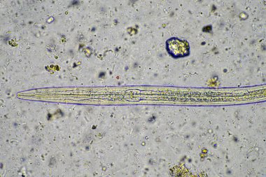 Biyoloji mikroskop altında amip, kırbaç, nematod, mantar, bakteri