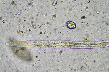 toprak mikroorganizmaları mikroskop altında amip, kırbaç, nematod, mantar, sağlıklı bir orman çalısı ulusal park araştırmasından bakteriler de dahil olmak üzere.