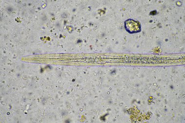 Avustralya 'da bir laboratuarda yenilenebilir tarım çiftliğindeki toprak örneğinden amip, kırbaç, nematod, mantar ve bakteri içeren toprak mikroorganizmaları mikroskop altında.