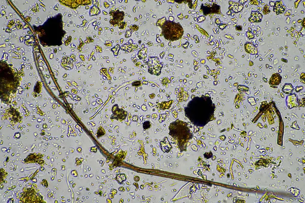 stock image microorganisms and soil biology, with nematodes and fungi under the microscope. in a soil and compost sample