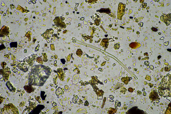 Stock image microorganisms and soil biology, with nematodes and fungi under the microscope. in a soil and compost sample