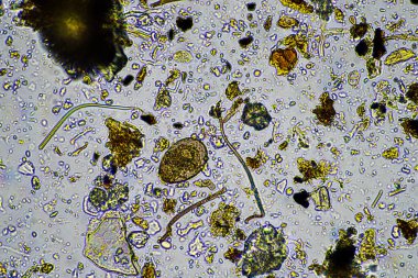 Biyoloji mikroskop altında amip, kırbaç, nematod, mantar, bakteri