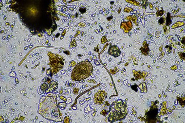 Bir laboratuarda amip, kırbaç, nematod, mantar, bakteri, virüs ve hayvan ve insan sağlığı hastalıklarını içeren mikroskop altında bulunan mikroorganizmalar
