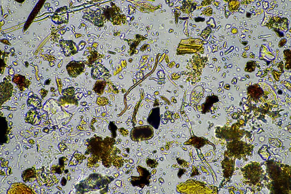 stock image soil microorganisms under a microscope including amoeba, flagellates, nematodes, fungi, bacteria, from a soil sample on a regenerative agriculture farm in Australia in a lab