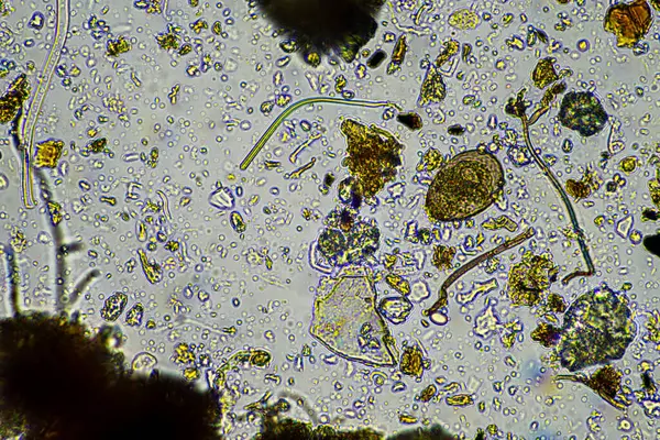 Biyoloji mikroskop altında amip, kırbaç, nematod, mantar, bakteri