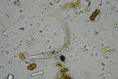 Kompost mikroorganizmaları mikroskop altında amip, kırbaç, nematodlar, mantarlar, bakteriler