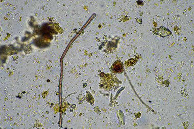 Avustralya 'da bir laboratuarda yenilenebilir tarım çiftliğindeki toprak örneğinden amip, kırbaç, nematod, mantar ve bakteri içeren toprak mikroorganizmaları mikroskop altında.