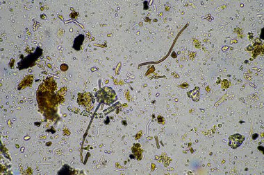 Kompost mikroorganizmaları mikroskop altında amip, kırbaç, nematodlar, mantarlar, bakteriler