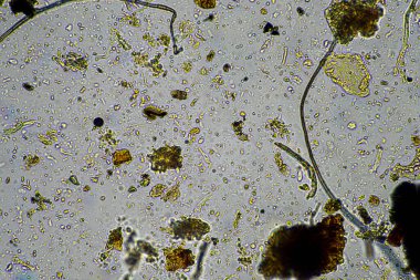 Bir laboratuarda amip, kırbaç, nematod, mantar, bakteri, virüs ve hayvan ve insan sağlığı hastalıklarını içeren mikroskop altında bulunan mikroorganizmalar