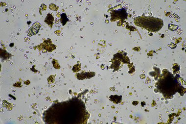 mikroorganizmalar ve toprak biyolojisi, mikroskop altında nematodlar ve mantarlar. Toprakta ve gübre örneğinde