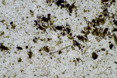 mikroorganizmalar ve toprak biyolojisi, mikroskop altında nematodlar ve mantarlar. Toprakta ve gübre örneğinde