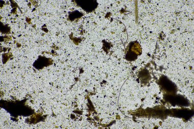 Mikroskopi altında toprak, kum, çamur ve toprak biyolojisi, amip, mantar, mikrop ve bir sığır çiftliğindeki nematodlara bakıyor.