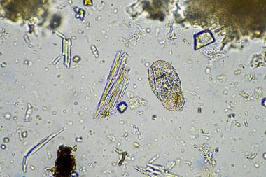 mikroorganizmalar ve toprak biyolojisi, mikroskop altında nematodlar ve mantarlar. Toprakta ve gübre örneğinde