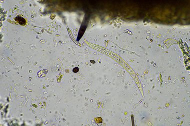 Mikroskopi altında toprak, kum, çamur ve toprak biyolojisi, amip, mantar, mikrop ve bir sığır çiftliğindeki nematodlara bakıyor.