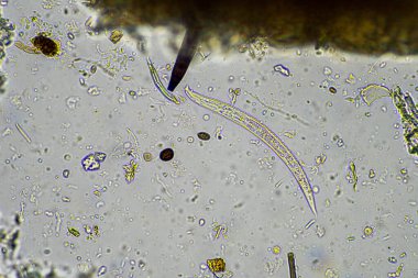 Avustralya 'da bir laboratuarda yenilenebilir tarım çiftliğindeki toprak örneğinden amip, kırbaç, nematod, mantar ve bakteri içeren toprak mikroorganizmaları mikroskop altında.