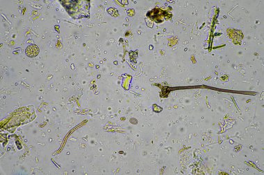 mikroorganizmalar ve toprak biyolojisi, mikroskop altında nematodlar ve mantarlar. Toprakta ve gübre örneğinde