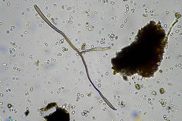 stock image compost microorganisms under a microscope including amoeba, flagellates, nematodes, fungi, bacteria