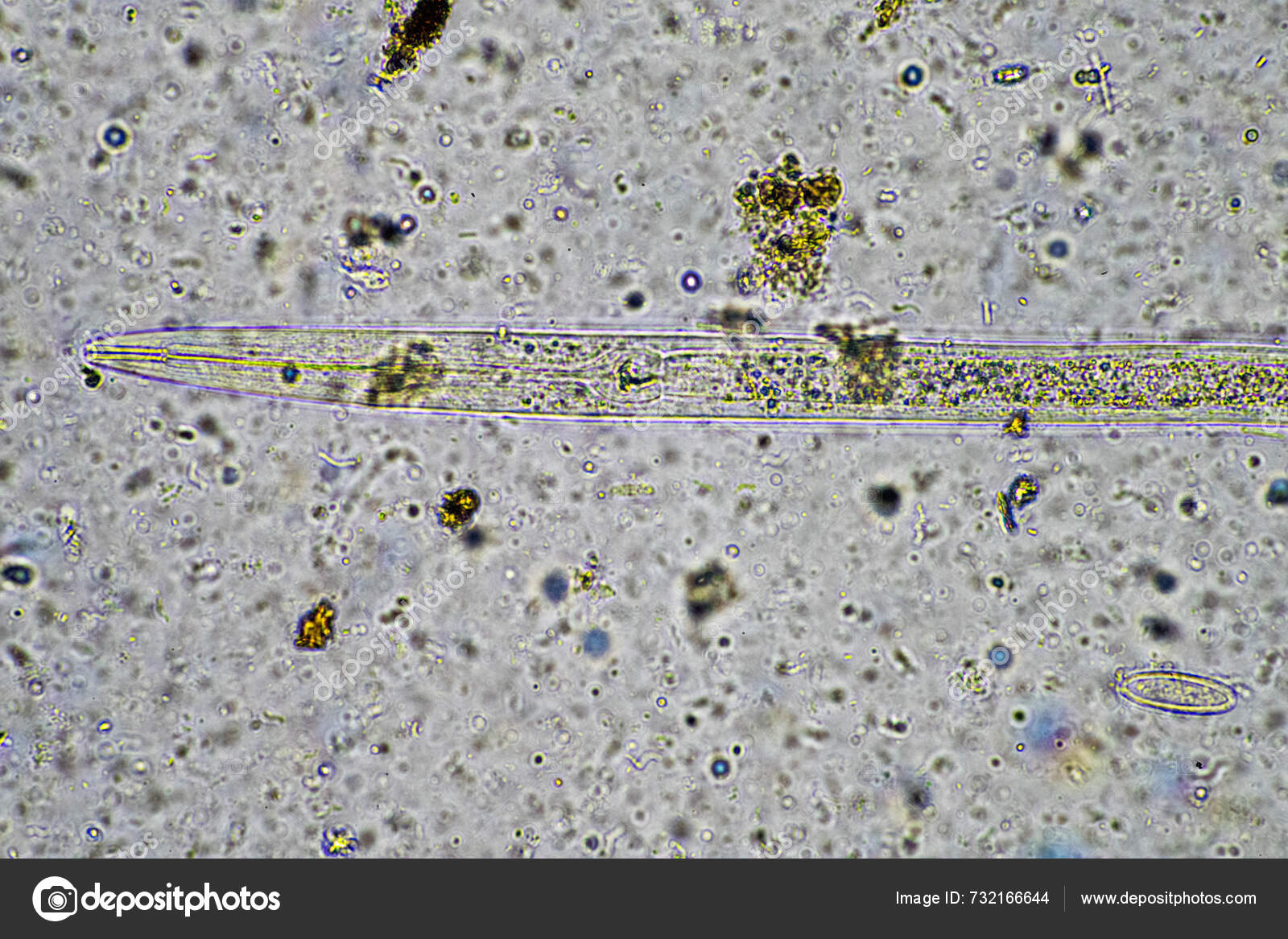 Compost Microorganisms Microscope Including Amoeba Flagellates ...