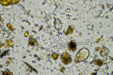 mikroorganizmalar ve toprak biyolojisi, mikroskop altında nematodlar ve mantarlar. Toprakta ve gübre örneğinde
