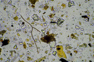 Bir laboratuarda amip, kırbaç, nematod, mantar, bakteri, virüs ve hayvan ve insan sağlığı hastalıklarını içeren mikroskop altında bulunan mikroorganizmalar