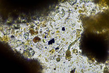 mikroorganizmalar ve toprak biyolojisi, mikroskop altında nematodlar ve mantarlar. Toprakta ve gübre örneğinde