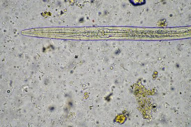 mikroorganizmalar ve toprak biyolojisi, mikroskop altında nematodlar ve mantarlar. Toprakta ve gübre örneğinde