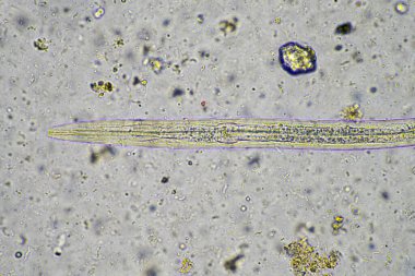 Avustralya 'da bir laboratuarda yenilenebilir tarım çiftliğindeki toprak örneğinden amip, kırbaç, nematod, mantar ve bakteri içeren toprak mikroorganizmaları mikroskop altında.