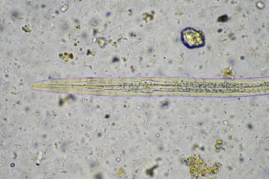 mikroorganizmalar ve toprak biyolojisi, mikroskop altında nematodlar ve mantarlar. Toprakta ve gübre örneğinde