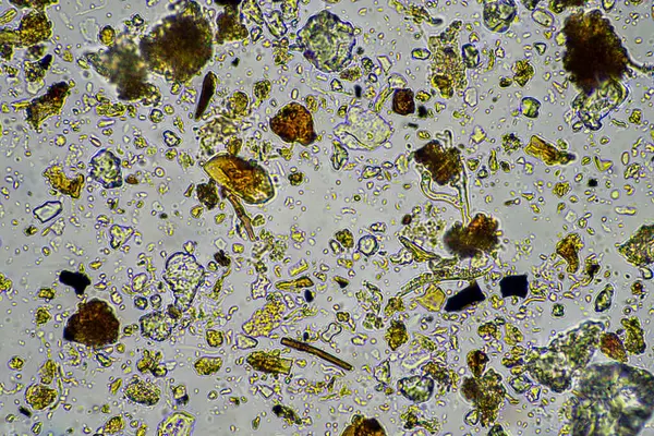 stock image soil microorganisms under a microscope including amoeba, flagellates, nematodes, fungi, bacteria, from a soil sample on a regenerative agriculture farm in Australia in a lab