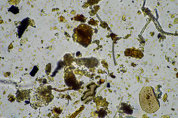 Avustralya 'da bir laboratuarda yenilenebilir tarım çiftliğindeki toprak örneğinden amip, kırbaç, nematod, mantar ve bakteri içeren toprak mikroorganizmaları mikroskop altında.