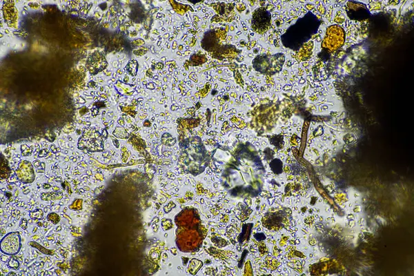 stock image compost microorganisms under a microscope including amoeba, flagellates, nematodes, fungi, bacteria