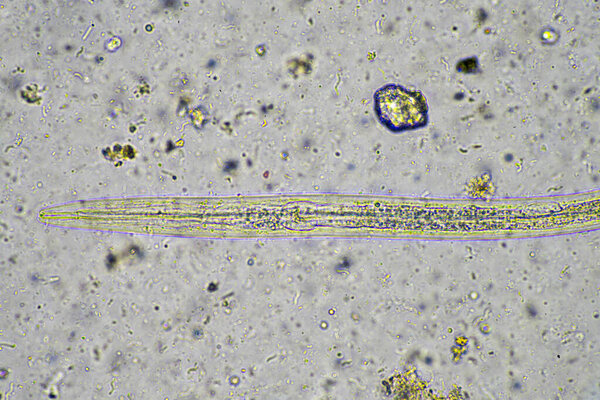 Soil under the microscopy, looking at sand, silt and clay and soil biology, amoebae, fungi, fungal, microbes and nematodes in a cattle farm