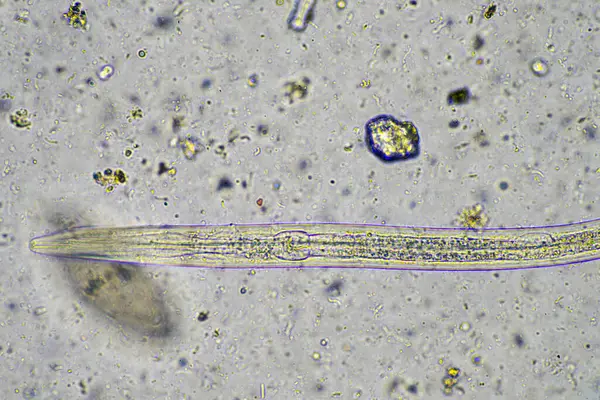 Avusturalya 'da bir çiftlikte mikroskop altında toprak mikroorganizmaları. 