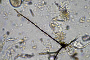 Bir laboratuarda amip, kırbaç, nematod, mantar, bakteri, virüs ve hayvan ve insan sağlığı hastalıklarını içeren mikroskop altında bulunan mikroorganizmalar