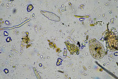 Avustralya 'da bir laboratuarda yenilenebilir tarım çiftliğindeki toprak örneğinden amip, kırbaç, nematod, mantar ve bakteri içeren toprak mikroorganizmaları mikroskop altında.