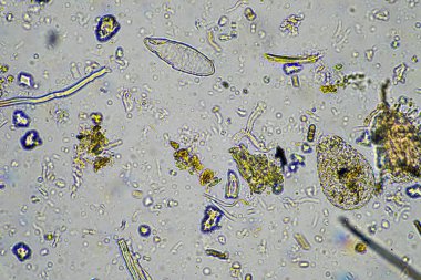 mikroorganizmalar ve toprak biyolojisi, mikroskop altında nematodlar ve mantarlar. Toprakta ve gübre örneğinde
